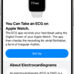 The ECG set up screen within the Health app on iPhone