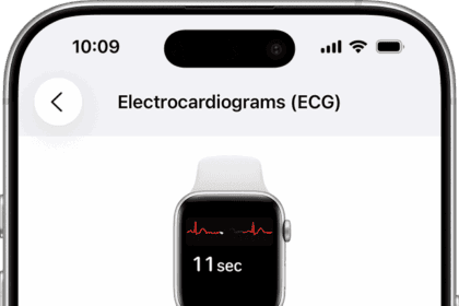The ECG set up screen within the Health app on iPhone
