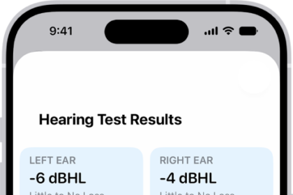 Hearing Test results on iPhone, showing little to no hearing loss in both ears. At the bottom are options to tap Done or set up Hearing Aid.