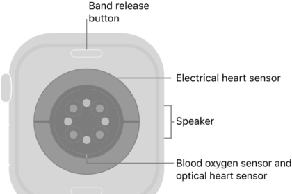 The back of Apple Watch Series 10, with the band release buttons at top and bottom, the electrical heart sensors, optical heart sensors, and blood oxygen sensors in the middle, and the speaker on the side.